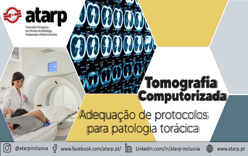 Curso Online Tomografia Computorizada - Adequação de protocolo para patologia torácica